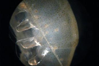 Larval worms encysted in shrimp abdomen