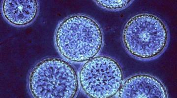 Microscope photo of seven blue circular phytoplankton