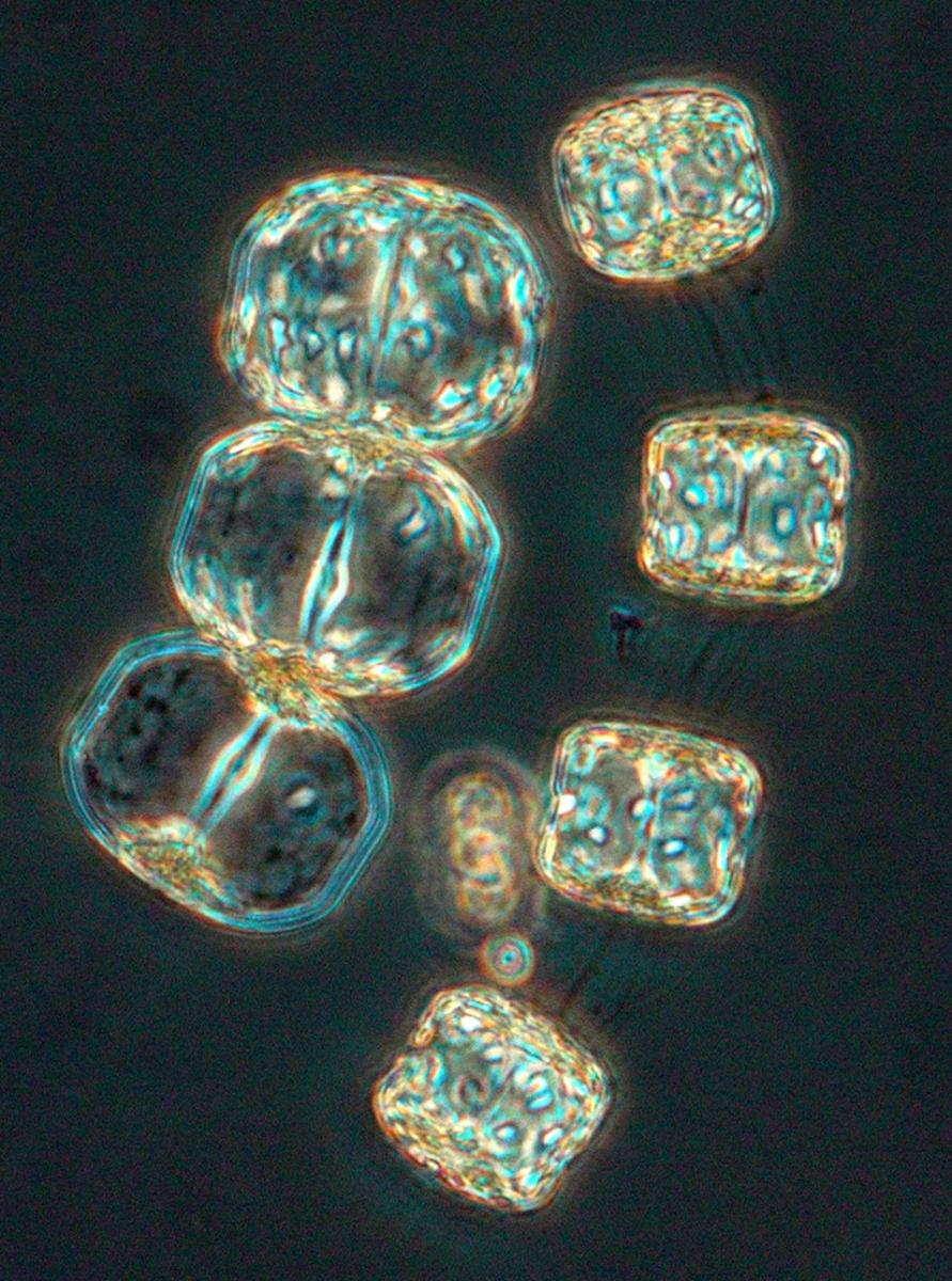 Phytoplankton - Porosira glacialis with Detonula